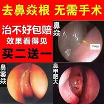 鼻炎喷雾中药鼻克灵喷剂鼻炎膏克星鼻甲肥大过敏性鼻塞鼻窦炎神器