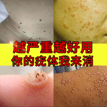 Verruca plana facial genuine Japanese removing ointment