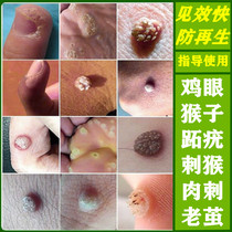 Special effects to remove meat wart monkey stick stick on monkey hands and feet body warts