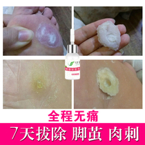 Seven-leaf foot calluses biofilm painless removal of cocoons hand cocoons corns foot pads high heel toes cocoons diced thorns