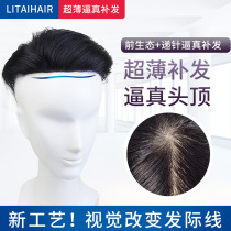 Mens wig Short hair handsome Korean version of the top of the head needle real hair replacement block male forehead baldness woven hair scalp