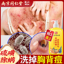 Sulfur to remove mites bacteriostasis and mites