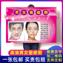 Men and womens face mole figure point mole freckle publicity poster beauty salon decoration facial tattoo display wall Wall Wall painting sticker