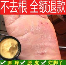 Beriberi cream root to follow the artifact to the foot skin cream Japanese antifungal incense feet feet itchy feet cool feet cleft feet anti-dryness