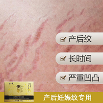 Japan Yihe stretch marks repair cream stretch marks postpartum elimination of obesity lines fade growth lines repair special light