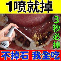 Removal of tartar calculus dissolution of calculus quick-acting remover plaque removal and cleaning artifact quitting