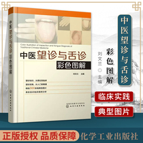 Genuine Chinese medicine inspection and tongue diagnosis color diagram Liu Wenlan editor-in-chief of Chinese medicine health inspection knowledge inspection practice basic skills of Chinese medicine diagnosis tongue diagnosis clinical case analysis of tongue diagnosis