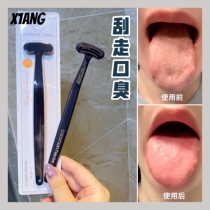 Did you brush your tongue today) South Korea commonHaus tongue cleaner scrapes bacteria to remove bad breath