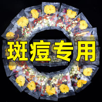 Rose chrysanthemum tea beauty beauty beauty skin acne spots conditioning endocrine fire heat detoxification detoxification health tea
