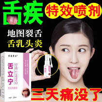 Papillitis of the tongue Cleft tongue map tongue thick white oral blistering mouth rotten sores redness pain Special analgesic spray