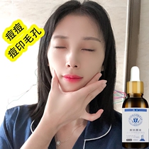 Eliminate acne pits and pits to repair acne scars desalination of acne and mens and womens anti-printing essence (shrinking pores)