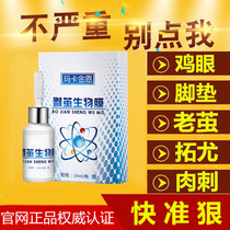 Remove chicken cocoon cocoon artifact Dead skin softener Hand and foot soles Maca Jinen cocoon stripping biofilm cocoon medicine