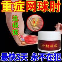 Special medicine patch for tennis elbow external humerus epicondylitis elbow joint pain lateral elbow pain soreness and swelling paste