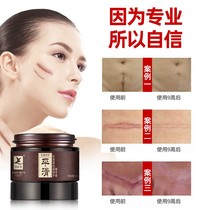 Scar removal repair ointment old scar asiatica gel scar care wound scratch to burn and scald surgical scar pregnancy