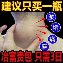(100% elimination) elimination of rich and expensive bag paste neck spondylosis neck pain neck pain in rich and expensive bag paste special deity