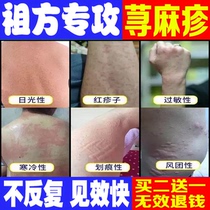 Urticaria allergy anti-itching root breaking special medicine wind force scratch skin itching special ointment for radical cure of skin itching