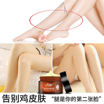 Eliminate chicken skin cream remove snake skin leg pimple to chicken skin horny lines remove dry moisturizing skin to red and black spots