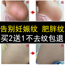 Obesity growth line tightening thigh student artifact to stretch marks repair cream to prevent pregnant women special postpartum elimination