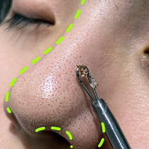 Dont squeeze the pores like spit out the dirt eliminate the facial pores 99% garbage available for men and women