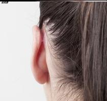 Wind ear orthotics ear stickers children fixed ear deformity baby anti-wind ear newborn hanging ear orthotics