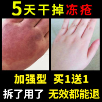 Frozen sore ointment for relieving itching frostbite ointment for detumescence and root treatment of hands face ears and frozen hands for children