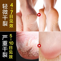 Heel dry cracked limbs Cracked Mouth Repair Cream Hands and feet Cracked Cream Feet Cracked Hand Foot Peeling Cracked anti-crack cream Horse oil
