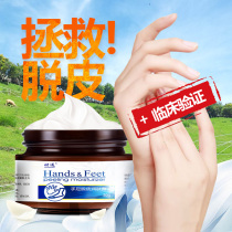 Seasonal palm peeling molting peeling peeling finger peeling childrens hand repair cream severe cracking