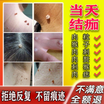 Remove the filamentous wart mole mole the neck the neck the meat the neck the meat the monkey the skin the skin