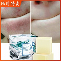 Sea Salt Soap Wash Cleanser Handmade Soap Whitening Pox Water Control Oil Wash Face Goat Soap