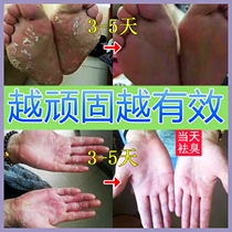 Guosu Xilin Ji small white bottle beriberi ointment four seasons foot Kang medicine yuan beauty skin Ningfu United States Australia official website