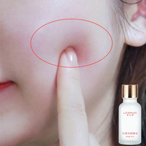 (Normal delivery) The spots are missing ~ Jingyan essential oil is dissatisfied with the refund ~ Buy 2 get 1 get 3 get 2
