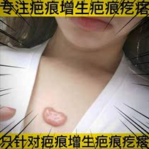 Scarring Removal of light scars on the chest Hyperplasia raised on the legs Raw mosquitoes Mosquito scars net care ointment