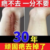 Xiaoba Fuwen Jingjing skin official website Jiufuba Zhizhen scar to remove ointment Hao Sha gel gel Likang to remove scar
