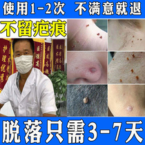  Remove thorn mole cream point monkey medicine Long small meat particles on the neck adenocarcinoma wart tumor convex mole skin fat removal artifact