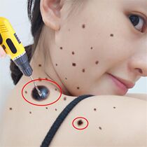  Where it is not scab where it is not clean where it is not clean remove all the black spots and spots on the face fade to black take 2 shots 3 shots etc