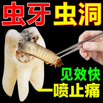 Toothache pain relief quick-acting medicine swelling pain inflammation nerve pulp wisdom tooth artifact moth tooth fire spray