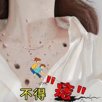 (Weiya recommends removing melanin) No scab remove all black spots on your face without scabs