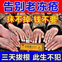 Frostbite ointment detumescence antipruritic anti-cracking and root treatment hand face and ear antifreeze repair artifact for boys and girls