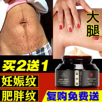 Hundred lines eliminate stretch marks obese lines remove male growth lines thighs students fade postpartum Repair Cream