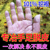 Heel dry crack repair cream hands and feet crack prevention chapped crack healing cream hands and feet peeling artifact