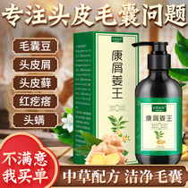  Kangwang anti-itch anti-dandruff shampoo Oil control ginger severe itch special dandruff artifact dew mites for men and women in addition to mites