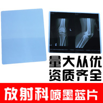 X-Ray Blue based inkjet medical film DR printing CR dental 8*10 orthopedic radiology dry film A4 roll