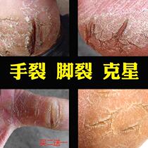 Cracked hands and feet cracked artifact dry peeling heel crack healing repair cream hand and foot crack prevention cracking cream