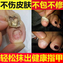 Damaged nail thickening repair bump growth liquid manicure repair fluid regeneration nutrient oil finger toenail rebirth