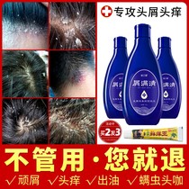 Crumbs clear anti-itching shampoo medicine severe dandruff drug nemesis anti-fungal mite oil control shampoo ointment