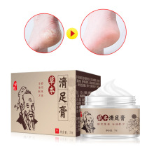  Deodorizing feet itchy feet Foot Care Herbal Beriberi Cream