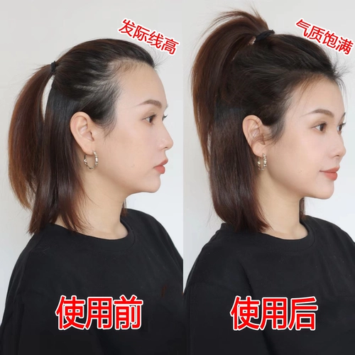 [Xiaohongshu Hot Push] и голые лысые волосы до естественного роста, размножение жидкости, чтобы стать более артефактами ~
