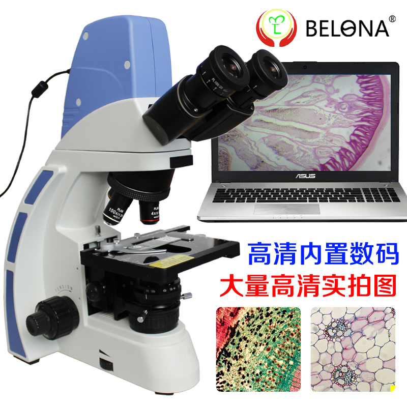 BELONA/Belang Built-in Digital Professional LED Biomicroscopy High Quality Professional Effect Super Clear