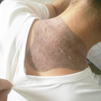 Cervical patch dredge neck shoulder and neck large vertebrae drum bag pain patch rich bag eliminate stick artifact moxibustion