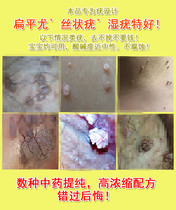 Treatment of male and female lettuce removal of wart body ointment private glans head foreskin vulva sharp wet wart medical external to